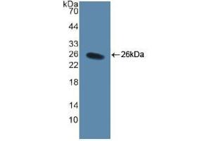 Western blot analysis of recombinant Human CD40L.
