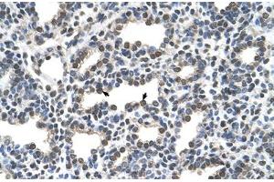 Immunohistochemical staining (Formalin-fixed paraffin-embedded sections) of human lung with KCTD6 polyclonal antibody . (KCTD6 anticorps  (AA 32-70))