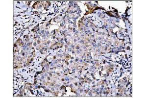 IHC analysis of NDE1 using anti-NDE1 antibody (ABIN7602401).