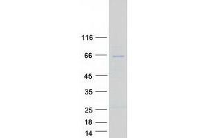 Validation with Western Blot