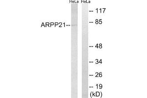 Western Blotting (WB) image for anti-cAMP-Regulated phosphoprotein, 21kDa (ARPP21) (Internal Region) antibody (ABIN1850975) (ARPP21 anticorps  (Internal Region))