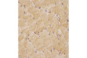 (ABIN6244021 and ABIN6578763) staining TK1 in human skeletal muscle tissue sections by Immunohistochemistry (IHC-P - paraformaldehyde-fixed, paraffin-embedded sections).