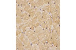 (ABIN6244021 and ABIN6578763) staining TK1 in human skeletal muscle tissue sections by Immunohistochemistry (IHC-P - paraformaldehyde-fixed, paraffin-embedded sections). (TK1 anticorps  (AA 139-173))