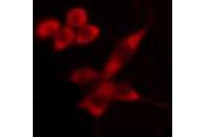 ABIN6274493 staining HeLa cells by IF/ICC.