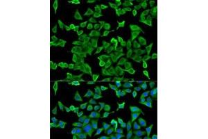 Immunofluorescence analysis of U2OS cells using ACTR2 Polyclonal Antibody (ACTR2 anticorps)