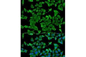Immunofluorescence analysis of U2OS cells using ACTR2 Polyclonal Antibody (ACTR2 anticorps)