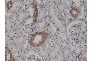 IHC testing of FFPE human kidney tissue with recombinant ACTA2 antibody at 1:2500.
