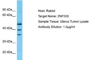 Host: Rabbit Target Name: ZNF528 Sample Type: Uterus Tumor lysates Antibody Dilution: 1. (ZNF528 anticorps  (Middle Region))