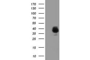 Western Blotting (WB) image for anti-Family with Sequence Similarity 84, Member B (FAM84B) antibody (ABIN1498215) (FAM84B anticorps)
