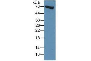 Rabbit Capture antibody from the kit in WB with Positive Control: Human BXPC-3 cells. (Moesin Kit ELISA)