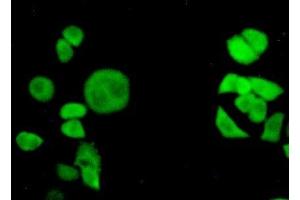 Detection of TNPO1 in Hela cells using Polyclonal Antibody to Transportin 1 (TNPO1) (Transportin 1 anticorps  (AA 593-836))