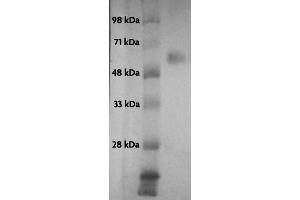 Recombinant p53 protein analyzed by Western blot.