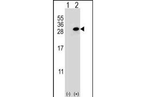 Western blot analysis of CLTA (arrow) using rabbit polyclonal CLTA Antibody (Center) (ABIN652956 and ABIN2842611). (CLTA anticorps  (AA 99-127))
