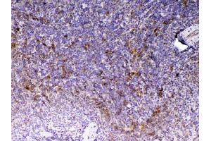 IHC analysis of CD14 using anti-CD14 antibody .