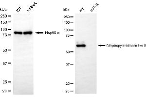 Western blotting analysis using dihydropyrimidinase like 5 antibody (ABIN7798340).