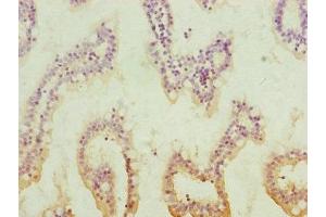 Immunohistochemistry of paraffin-embedded human small intestine tissue using ABIN7154039 at dilution of 1:100 (QRSL1 anticorps  (AA 289-528))