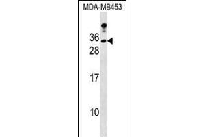 LIN7A Antibody (C-term) (ABIN1536800 and ABIN2848886) western blot analysis in MDA-M cell line lysates (35 μg/lane). (LIN7A anticorps  (C-Term))