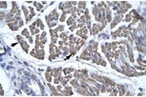 Immunohistochemical staining (Formalin-fixed paraffin-embedded sections) of human skeletal muscle with EYA3 polyclonal antibody  at 4-8 ug/mL working concentration. (EYA3 anticorps  (Internal Region))