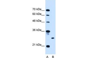 Western Blotting (WB) image for anti-Ring Finger Protein 39 (RNF39) antibody (ABIN2462699) (RNF39 anticorps)