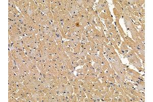 LRP6 Mouse Monoclonal Antibody at 1/100 staining rat heart tissue by IHC-P. (LRP6 anticorps  (C-Term))