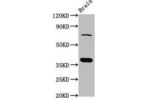 Western Blot Positive WB detected in: Rat brain tissue All lanes: SCAMP1 antibody at 4 μg/mL Secondary Goat polyclonal to rabbit IgG at 1/50000 dilution Predicted band size: 38, 19 kDa Observed band size: 38 kDa (SCAMP1 anticorps  (AA 2-134))