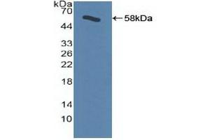 Detection of Recombinant ADRbK1, Human using Polyclonal Antibody to Beta Adrenergic Receptor Kinase (BARK)