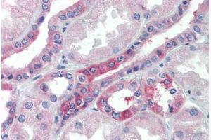 Human Kidney (formalin-fixed, paraffin-embedded) stained with SLC25A28 antibody ABIN462242 followed by biotinylated goat anti-rabbit IgG secondary antibody ABIN481713, alkaline phosphatase-streptavidin and chromogen.
