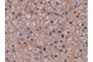 Detection of GSTp in Human Liver Tissue using Polyclonal Antibody to Glutathione S Transferase Pi (GSTp)