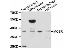 Western blot analysis of extracts of various cell lines, using MC3R antibody. (MC3R anticorps)