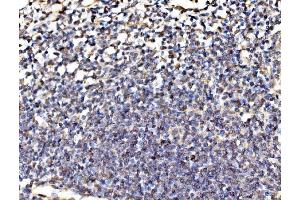 IHC analysis of Kinectin 1/KTN1 using anti-Kinectin 1/KTN1 antibody (ABIN7601096). (KTN1 anticorps  (AA 283-827))