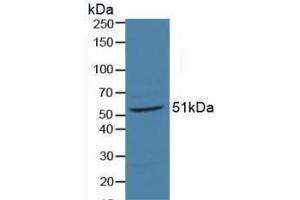 Western blot analysis of Pig Liver Tissue. (Retinoic Acid Receptor alpha anticorps  (AA 68-173))