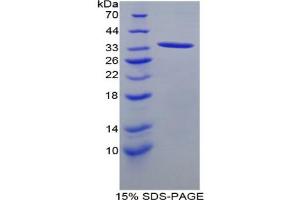 SDS-PAGE analysis of Rat ANGPTL1 Protein. (ANGPTL1 Protéine)