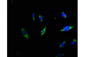 Immunofluorescence staining of U251 cells with ABIN7173353 at 1:66, counter-stained with DAPI. (Triadin anticorps  (AA 75-161))