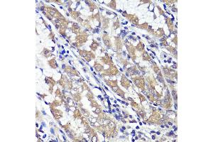 Immunohistochemistry of paraffin-embedded human stomach using UBL3 antibody (ABIN6131930, ABIN6149849, ABIN6149850 and ABIN6220468) at dilution of 1:100 (40x lens). (UBL3 anticorps  (AA 1-117))