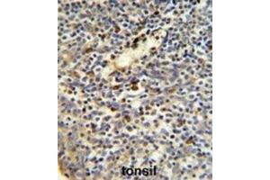 Immunohistochemistry (IHC) image for anti-FK506 Binding Protein 11, 19 KDa (FKBP11) antibody (ABIN3002801)