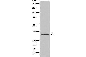 Western blot analysis of Orai1 expression in human platelet lysate.