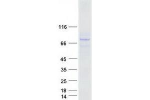 Validation with Western Blot