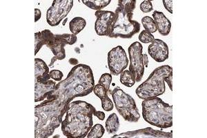 Immunohistochemical staining of human placenta with TJAP1 polyclonal antibody  shows strong granular cytoplasmic positivity in trophoblastic cells. (TJAP1 anticorps)