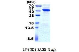 Figure annotation denotes ug of protein loaded and % gel used. (IMPAD1 Protéine)