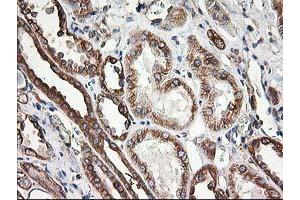 Image no. 3 for anti-Tubulin beta 4a (TUBB4A) antibody (ABIN1501580)