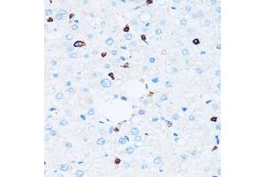 Immunohistochemistry of paraffin-embedded human liver using SPN antibody (ABIN5973813) at dilution of 1/100 (40x lens). (CD43 anticorps)