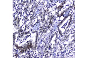 IHC analysis of MDC1 using anti-MDC1 antibody .