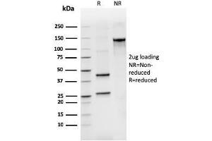 SDS-PAGE Analysis Purified BCL2L2 Mouse Monoclonal Antibody (CPTC-BCL2L2-2).