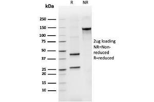 SDS-PAGE Analysis Purified BCL2L2 Mouse Monoclonal Antibody (CPTC-BCL2L2-2). (BCL2L2 anticorps)