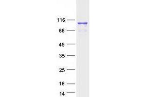 Validation with Western Blot