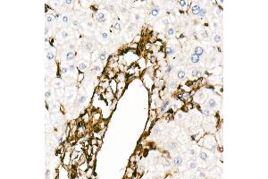 Immunohistochemistry of paraffin-embedded Human liver using Vimentin antibody (ABIN7271326) at dilution of 1:100 (40x lens).