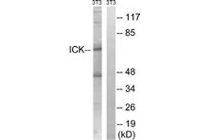 Western blot analysis of extracts from NIH-3T3 cells, treated with PBS 10uM 60', using ICK (Ab-159) Antibody. (ICK anticorps  (AA 125-174))