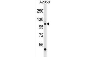 Western Blotting (WB) image for anti-ER Degradation Enhancer, Mannosidase alpha-Like 3 (EDEM3) antibody (ABIN2998830) (EDEM3 anticorps)