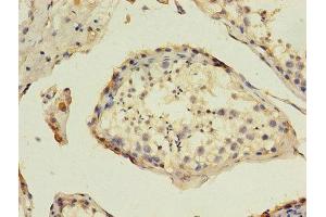Immunohistochemistry of paraffin-embedded human testis tissue using ABIN7155031 at dilution of 1:100 (HAVCR1 anticorps  (AA 21-290))