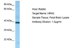 Western Blotting (WB) image for anti-Histamine Receptor H2 (HRH2) (C-Term) antibody (ABIN2790187) (HRH2 anticorps  (C-Term))